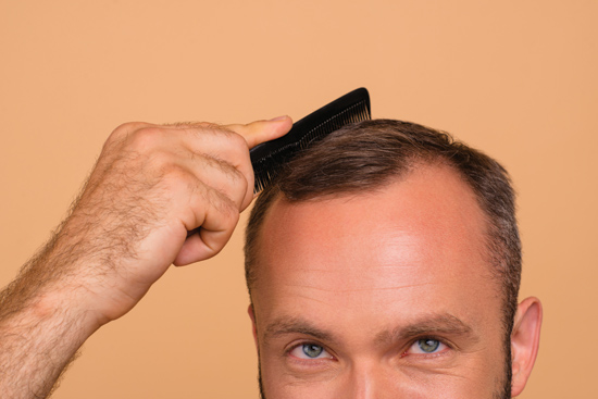 What are the hairstyle or haircut options for bald or balding men? - Quora